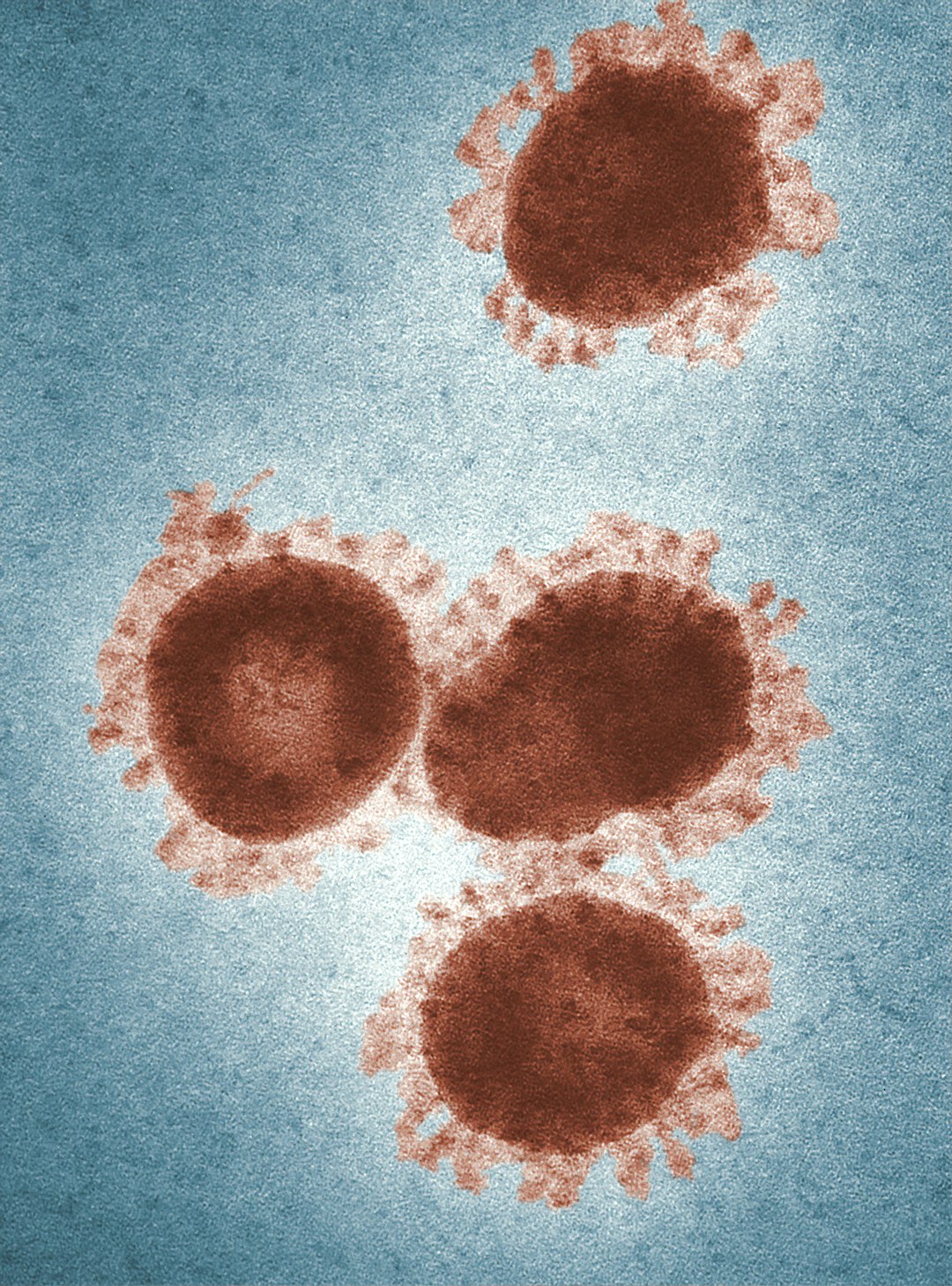 Hepatitis C Screening (image credits: unsplash)