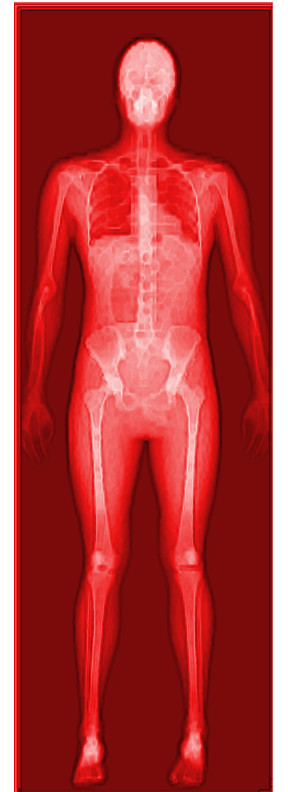 Bone Density Testing (image credits: flickr)