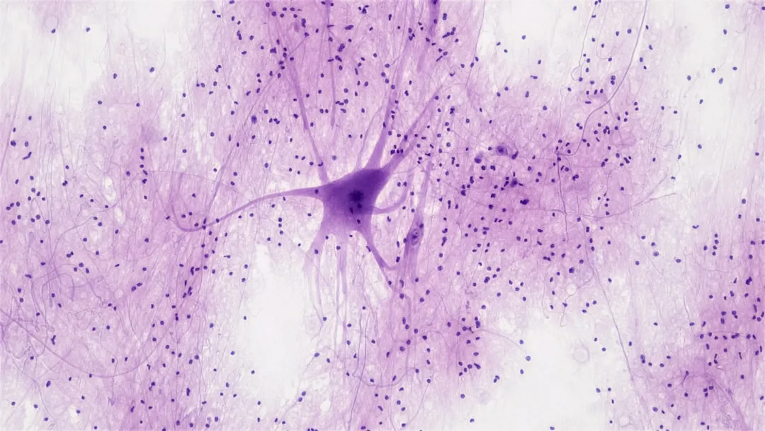 The Hippocampus and Its Role in Mapping New Spaces (Image Credits: Unsplash)