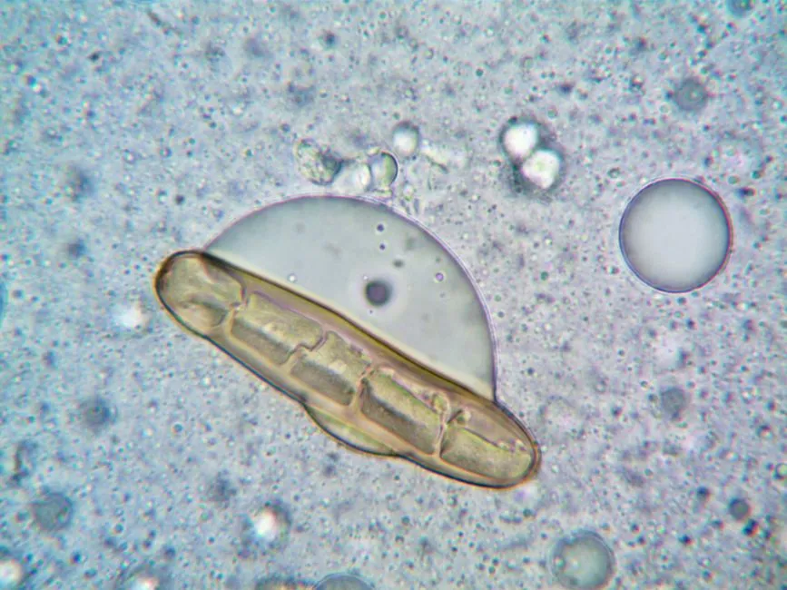 The Giardia Numbers Are More Nuanced Than the Internet Debate Suggests (Image Credits: Pexels)
