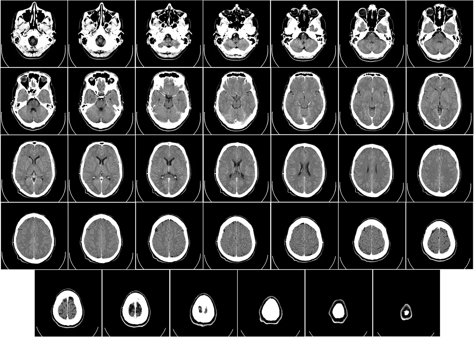 The Neuroscience Behind "Something Feels Off" (Radiology, Uppsala University Hospital. Uploaded by Mikael Häggström., CC0)