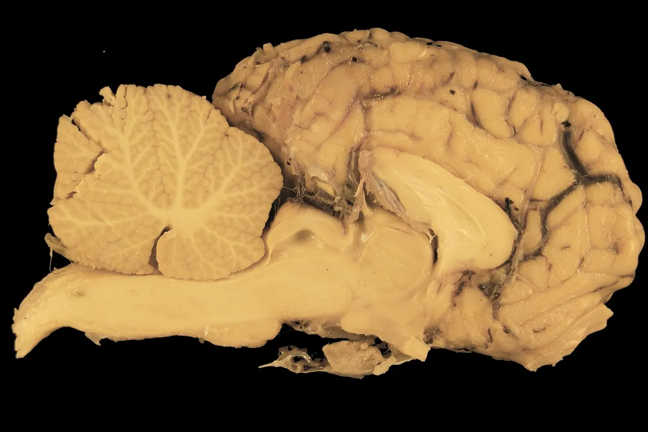 The Cerebellum's Expanding Role in Environmental Awareness (Image Credits: Pixabay)